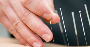Inner Space Acupuncture