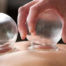 TCM Cupping Therapy