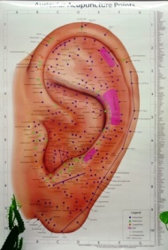 Ear reflexology, also called Auricular Therapy 